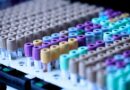 Rows of sample collection tubes with coloured caps in a laboratory