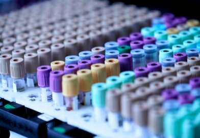 Rows of sample collection tubes with coloured caps in a laboratory