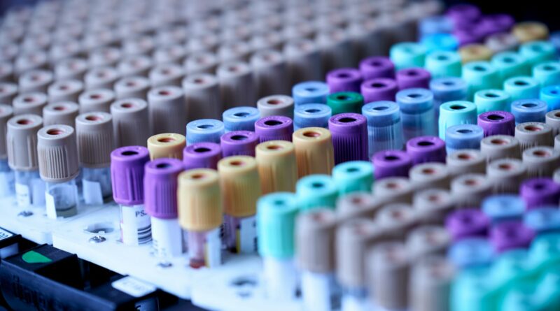 Rows of sample collection tubes with coloured caps in a laboratory