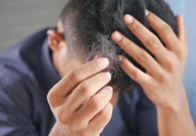 A man holding strands of fallen hair in his hand at the back of his head