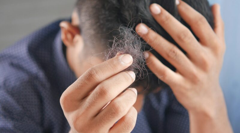 A man holding strands of fallen hair in his hand at the back of his head